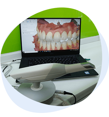 intra oral scanner